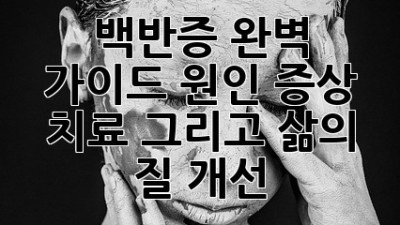백반증, 완벽 가이드: 원인, 증상, 치료 그리고 삶의 질 개선